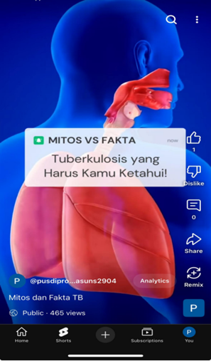 Tuberculosis: Meluruskan Persepsi, Mengungkap Kebenaran Melalui Fakta dan Mitos Tuberculosis: Meluruskan Persepsi, Mengungkap Kebenaran Melalui Fakta dan Mitos